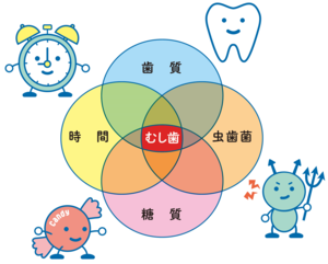 むし歯の原因