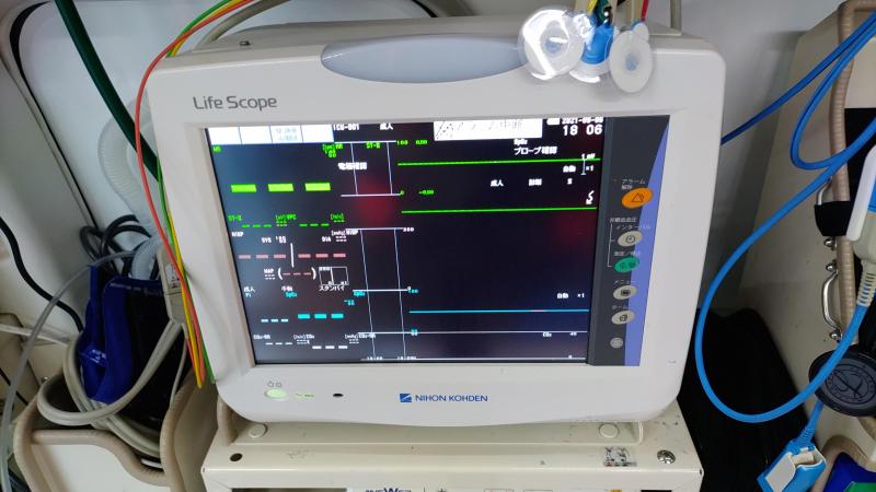 心電図モニター写真